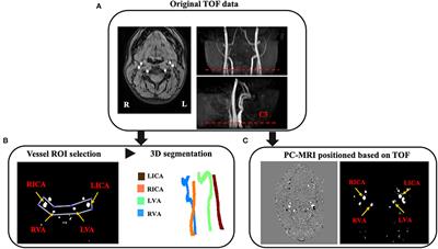 Age-Related Tortuosity of Carotid and Vertebral Arteries: Quantitative Evaluation With MR Angiography